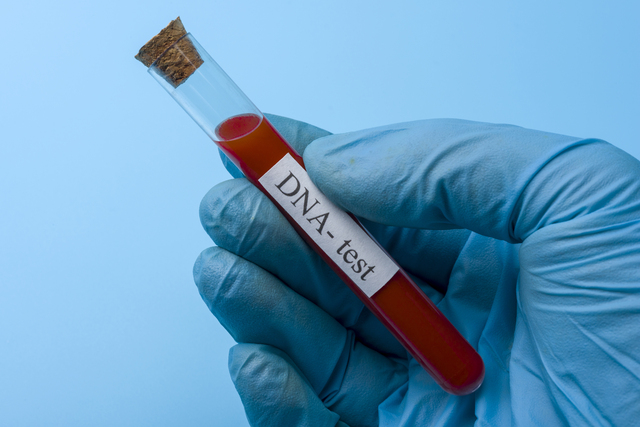 San Leandro, CA – DNA & Paternity Test Procedure & Advice from a Family Lawyer
